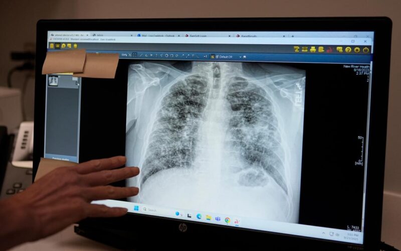 Lung cancer: a scan that detects early and an injection that may prevent it