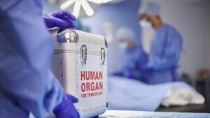 Maternity need not be proved through DNA test before donating kidney to child: Madras High Court