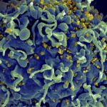 एक छोटे अध्ययन से संकेत मिले कि इम्यून कोशिकाओं को सक्रिय करना HIV से लड़ने में मददगार हो सकता है