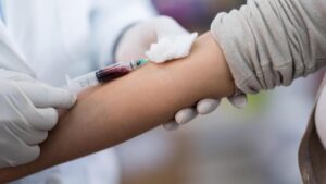 Blood test could help detect signs of Alzheimer's disease decades before symptoms: Study
