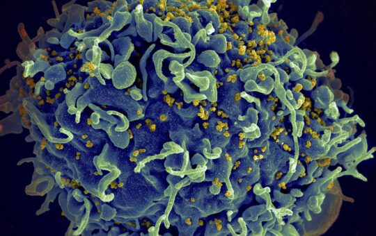 Small study hints that revving up immune cells might help fight HIV